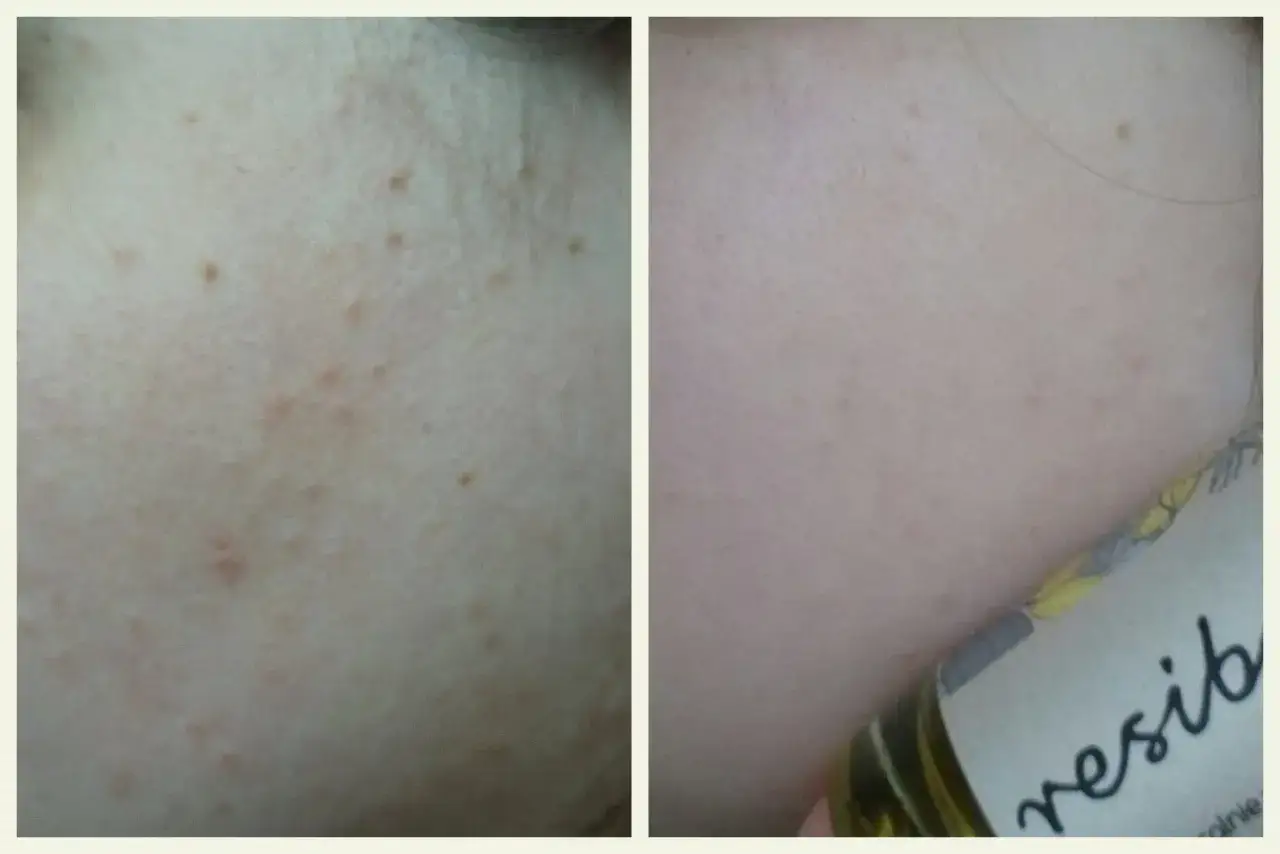 Zdjęcie Czy serum przed czy po maseczce? Sekret idealnej pielęgnacji skóry
